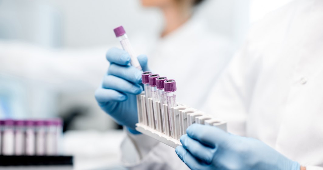 Mărfurile care prezintă suspiciuni vor fi verificate de Laboratorul Vamal